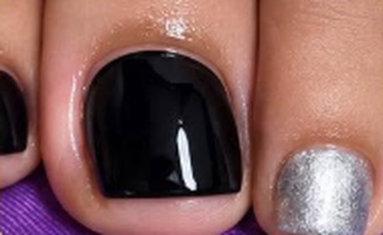 Toenails in glossy black and silver glitter