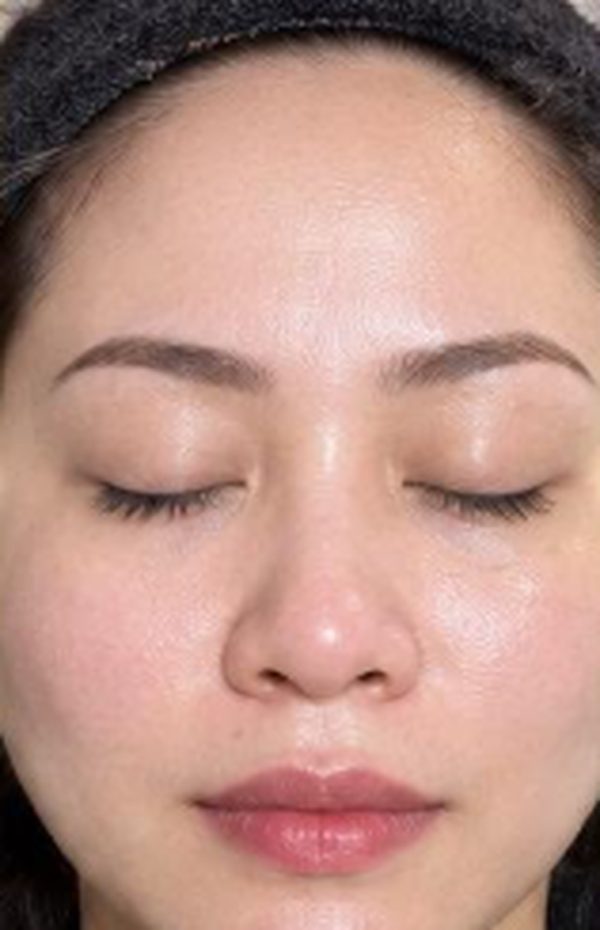 Client with clear, even skin and eyes closed after a facial
